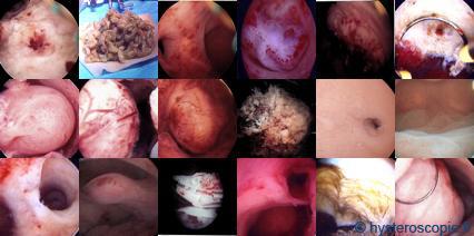 Les Pathologies
